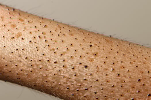 Close-up of Human Skin with Hairs and Pores photo
