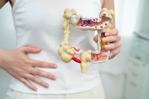 Intestine, Asian woman holding human anatomy model photo