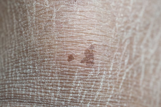 Close-up of skin texture with small brown spots and lines photo