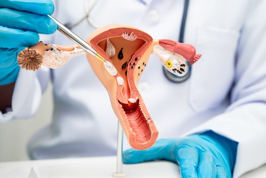 Uterus doctor holding human anatomy model for study diagnosis and treatment photo