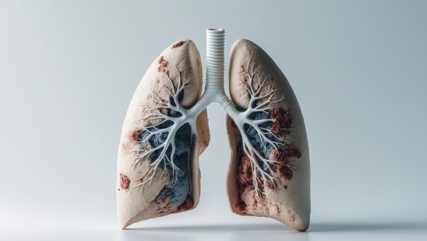 A preserved human lung model exhibiting signs of medical pathology photo