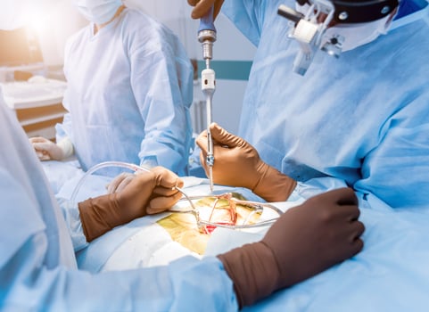 Spinal surgery. Surgeon tightens the polyaxial screw into the patient's spine photo
