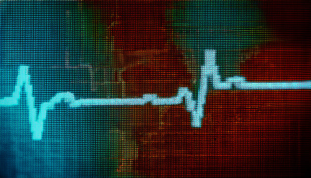 Heartbeat Graphic Displayed on a Digital Screen With Vibrant Colors Indicating Health Data Trends and Monitoring Changes photo