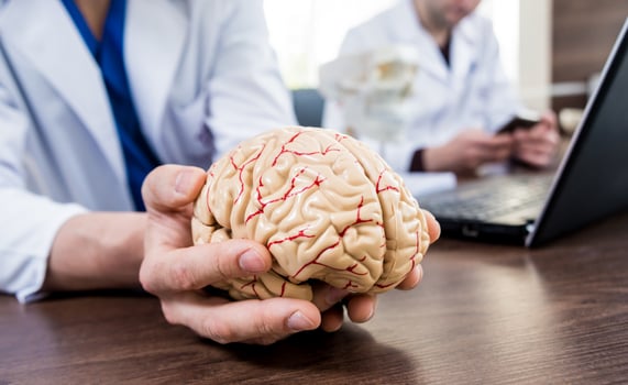 Doctor holding plastic model of human brain. photo