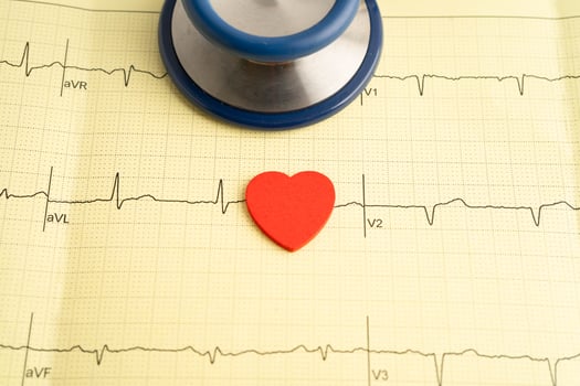 Stethoscope on electrocardiogram ECG, heart wave, heart attack, cardiogr photo
