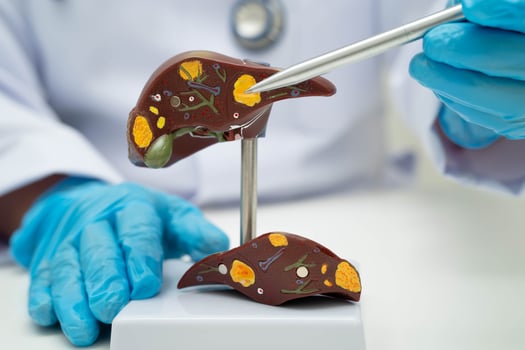 Liver with gallbladder, pancreas spleen and duodenum, Asian doctor holding human anatomy model for study diagnosis and treatment in hosp photo