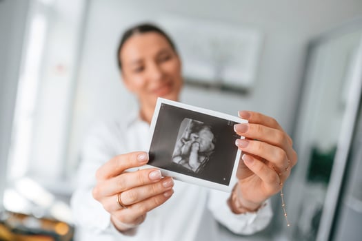 Standing, and ,smiling. Woman in white coat is holding ultrasound picture of baby photo
