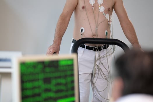 A middle-aged man is undergoing a medical stress test on a treadmill, connected to ECG electrodes for heart monitoring in a clinical environment photo