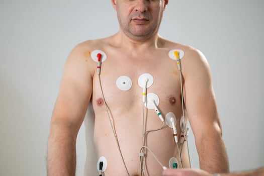 A middle-aged man is undergoing a medical stress test on a treadmill, connected to ECG electrodes for heart monitoring in a clinical environment photo