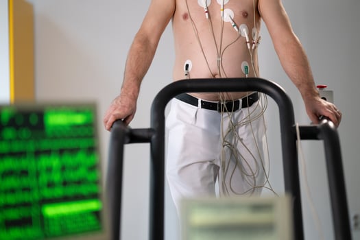 A middle-aged man is undergoing a medical stress test on a treadmill, connected to ECG electrodes for heart monitoring in a clinical environment photo