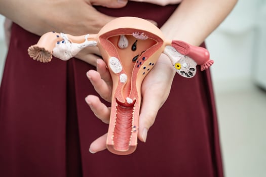 Uterus, Asian, woman holding photo