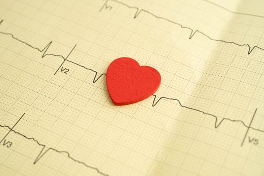 Electrocardiogram ECG, heart wave, heart attack, cardio photo