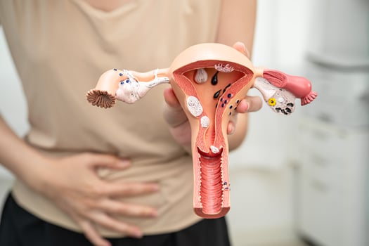 Uterus, Asian, woman holding human anatomy model. photo