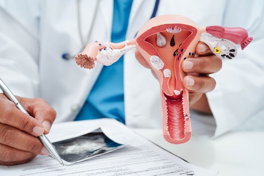 Uterus, Asian, woman holding human anatomy model. photo