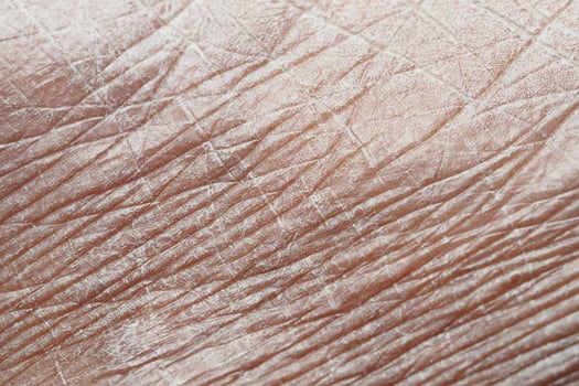 Detailed close-up of textured skin revealing age and characteristics photo