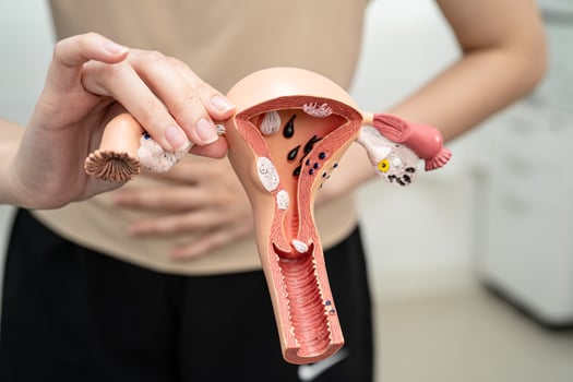 Uterus woman holding human anatomy model. photo