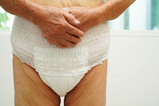 Asian senior woman patient wearing adult incontinence diaper pad in hos photo