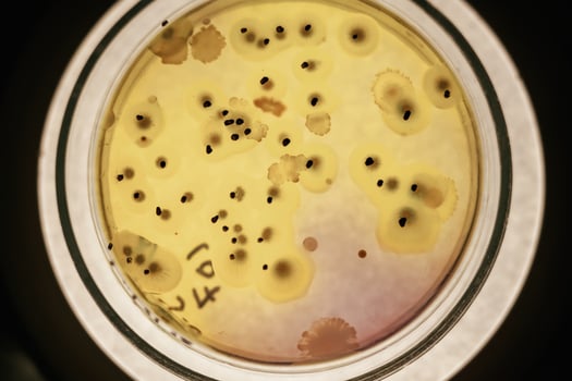 Close up focused, view ,of Trichoderma in the rounded lab container photo
