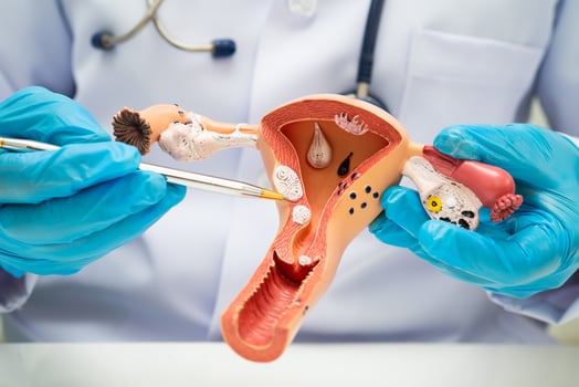 Uterus doctor holding human anatomy model for study diagnosis and photo