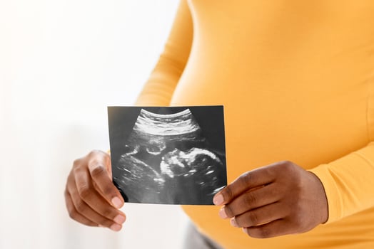 Unrecognizable pregnant african american woman holding ultrasound image of her unborn child, standing by window at home, copy space. Cropped of black lady with big tummy showing sonogram photo