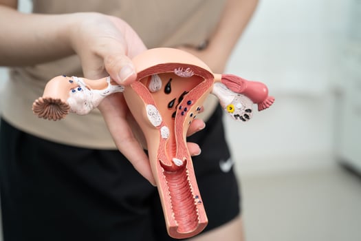 Uterus woman holding human photo