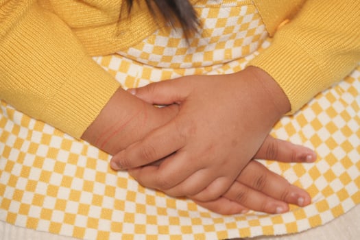 Child's hands resting on a yellow checkered dress reveal innocence photo