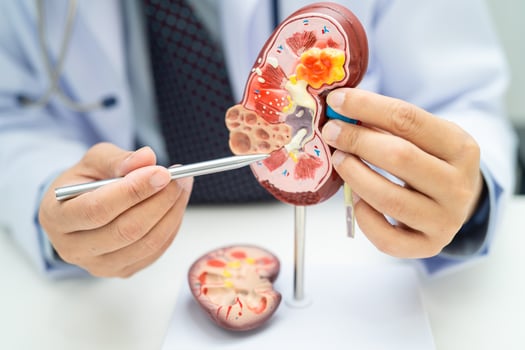 Kidney disease Chronic kidney disease ckd, Doctor hold human photo