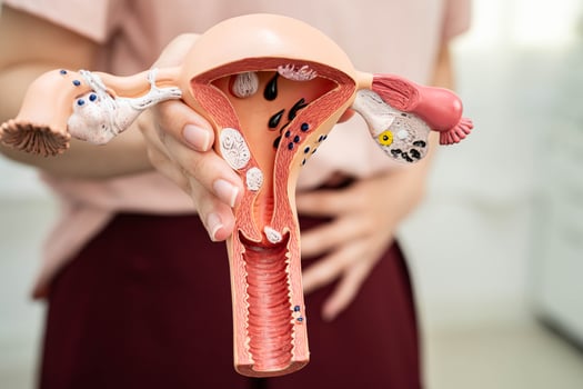 Uterus woman holding human anatomy model. photo