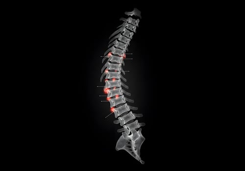 Spine x ray medical image photo