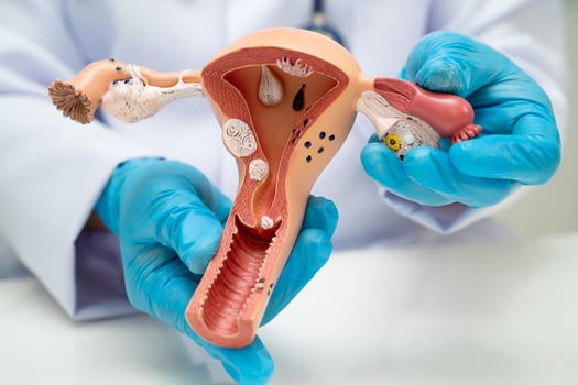 Uterus doctor holding human anatomy model for study diagnosis and treatment in hospital. photo