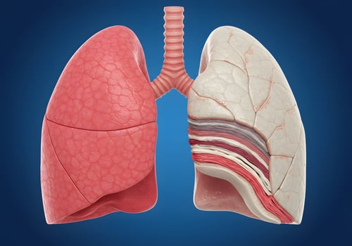 Healthy and diseased lungs medical illustration photo