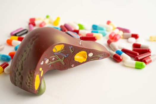 Liver model with pill drug treatment, Cirrhosis, Liver cancer, fatty liver. photo