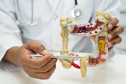 Intestine appendix and digestive system, doctor holding anatomy model for study diagnosis and treatment in hospital. photo