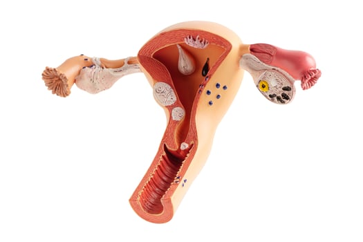 Uterus human model isolated on white background with clipping path. photo