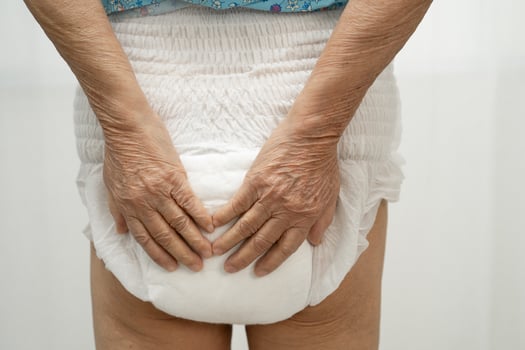 senior woman patient wearing incontinence diaper. photo