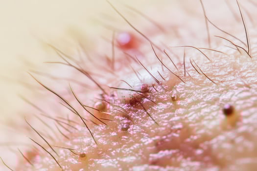 Close up view of human skin with fine hair details photo