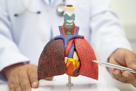 Pneumonia, lung cancer doctor holding human anatomy model for study diagnosis photo