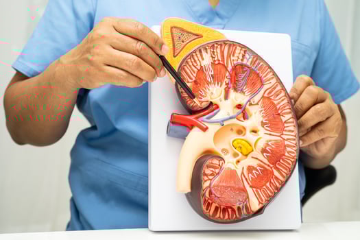 Kidney disease Chronic kidney disease ckd, Doctor hold human model photo