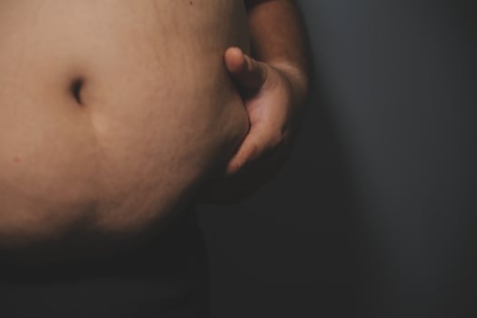A man with a large belly on his chest photo