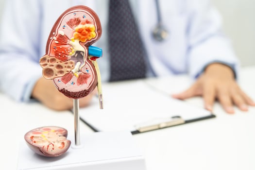 Chronic kidney disease ckd, Doctor hold human model to treat and study in hospital. photo