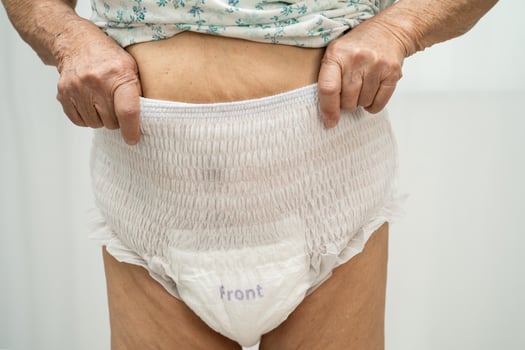 Asian senior woman patient wearing adult incontinence diaper pad in hospital. photo