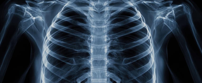 The detailed anatomy of a human chest shown through an X-ray image. photo