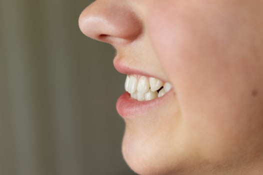 Even white healthy teeth of a child or person close-up side view. Correct bite of teeth photo