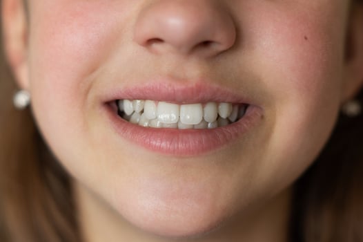 Even white healthy teeth of a child or person close-up front view. Correct bite of teeth photo