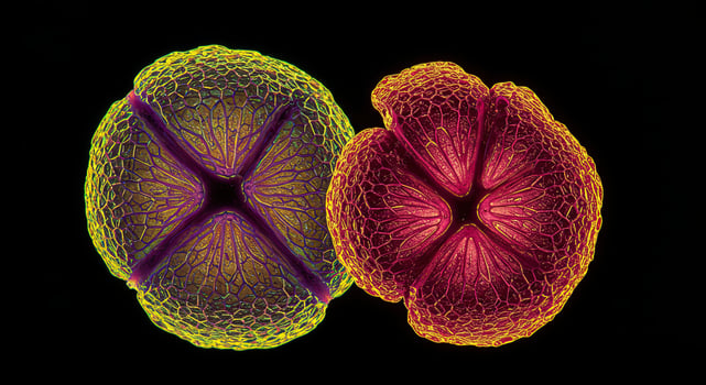 Microscopic Close-up of Two Colorful Seed Pods photo