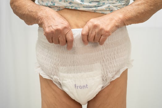 senior woman patient wearing adult incontinence diaper pad photo