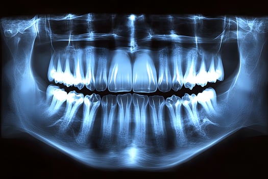 Dental X-Ray Imaging for Oral Health Diagnosis and Treatment Planning photo