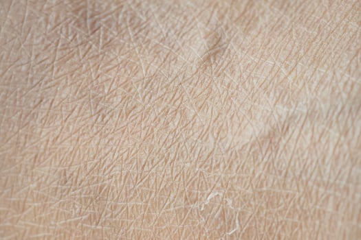 Close-up view of dry textured skin revealing fine details photo
