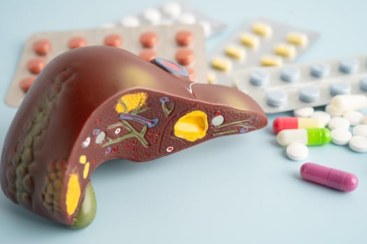 Liver model with pill drug treatment photo