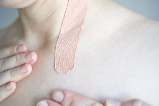 Caucasian adult female with skin tape on shoulder. close-up of healthcare and skincare treatment. photo